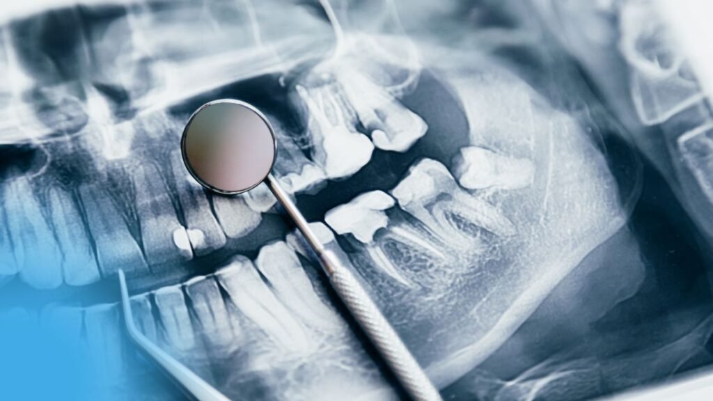 Indications et contre-indications des traitements endodontiques