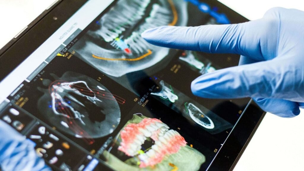 IMAGERIE MÉDICALE EN OCE