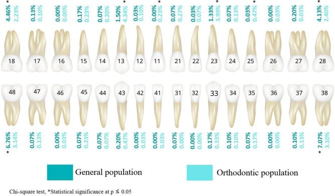 tooth impaction frequency diagram dental arch