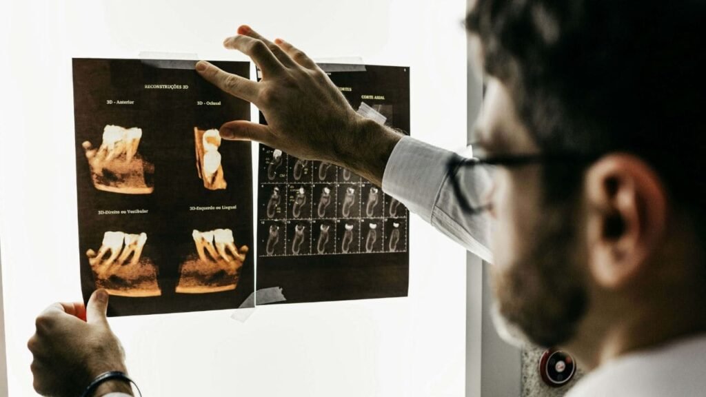 Les défauts osseux parodontaux : Modalités thérapeutiques