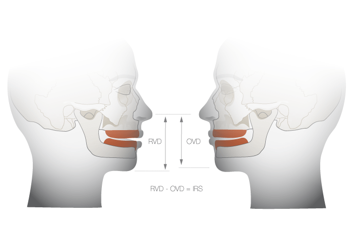 Visage de profil montrant la hauteur faciale verticale