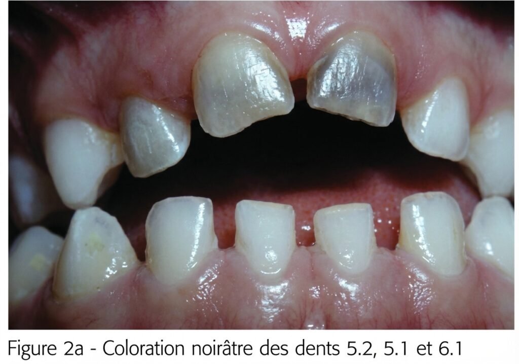 Dyschromies médicame