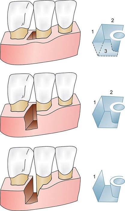 Classification Goldman & Cohen