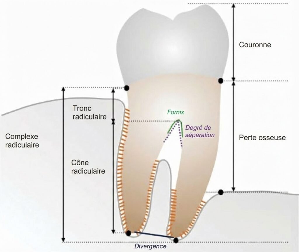 tooth furcation anatomy diagram trifurcation bifurcation Anatomie de la furcation