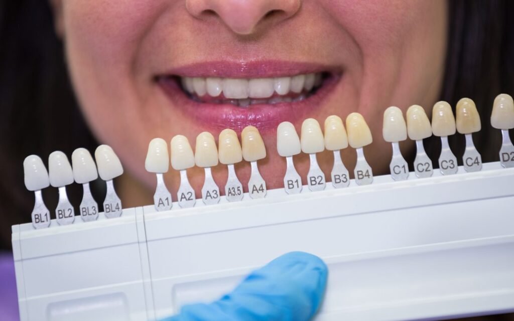 tooth color analysis shade guide natural light dental