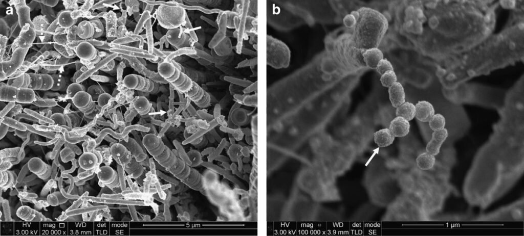 L'ultrastructure de la plaque dentaire sous-gingivale, révélée par microscopie électronique à balayage à émission de champ à haute résolution