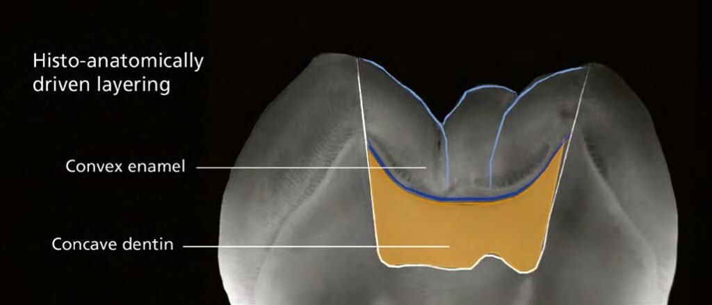 dental composite layering technique enamel dentin layers