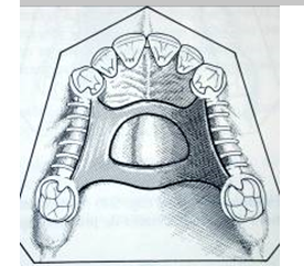 Die Bestandteile des Metallchassis