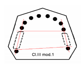 Entwurf des Metallrahmenlayouts