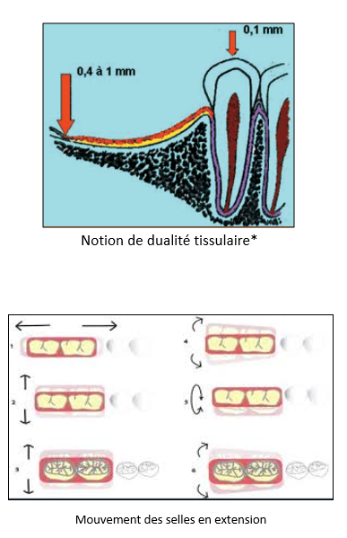 TRATAMIENTO DE LA EDÉNTULA DISTAL