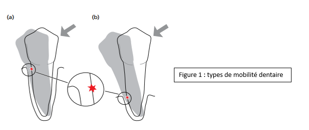 Movilidad dental: etiologías y clasificaciones