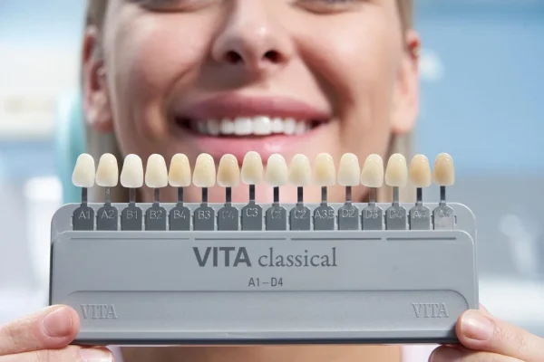 vita shade guide tooth color matching dental