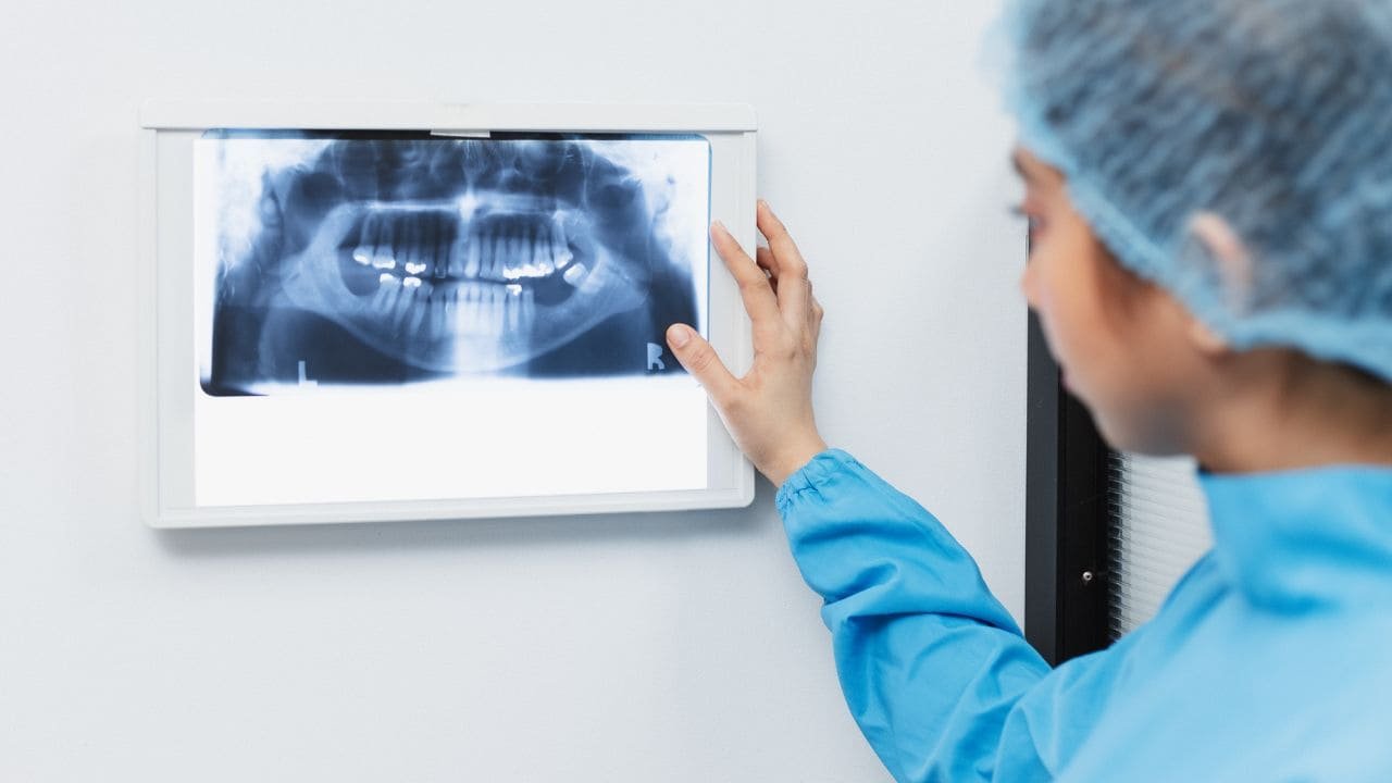 Asepsie, antisepsie, stérilisation.