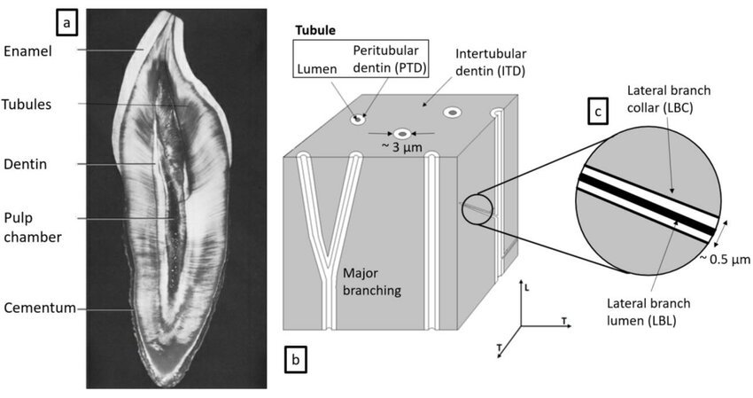 dental dentin microstructure cross section microscopy