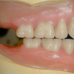 Dents plates sans relief cuspidien pour l'occlusion monoplan