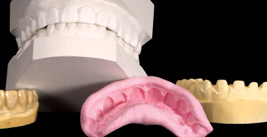 dental wax-up diagnostic study model