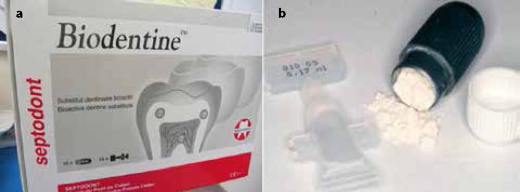 tricalcium silicate powder dental material