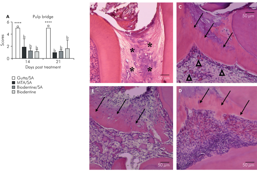 dental pulp repair hydroxyapatite formation histology Biodentine