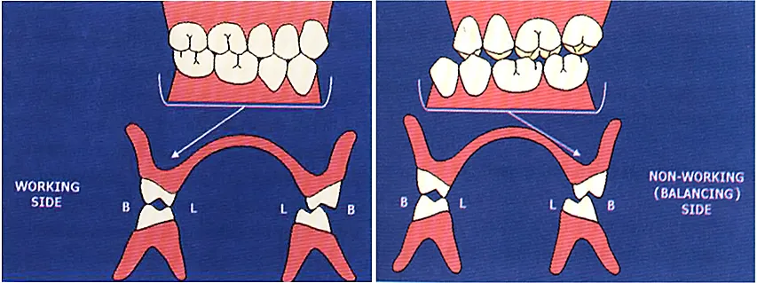 working side non-working side occlusion contacts