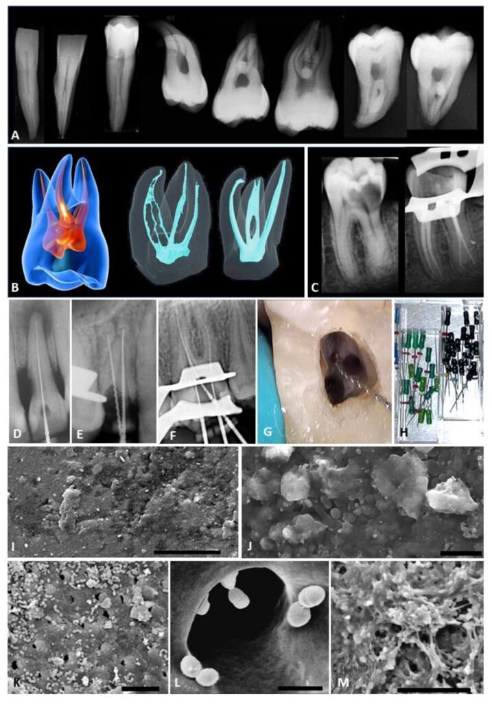 Illustrer visuellement les germes anaérobies - anaerobic bacteria dental canal microscopy