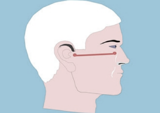  Le plan axio-orbitaire