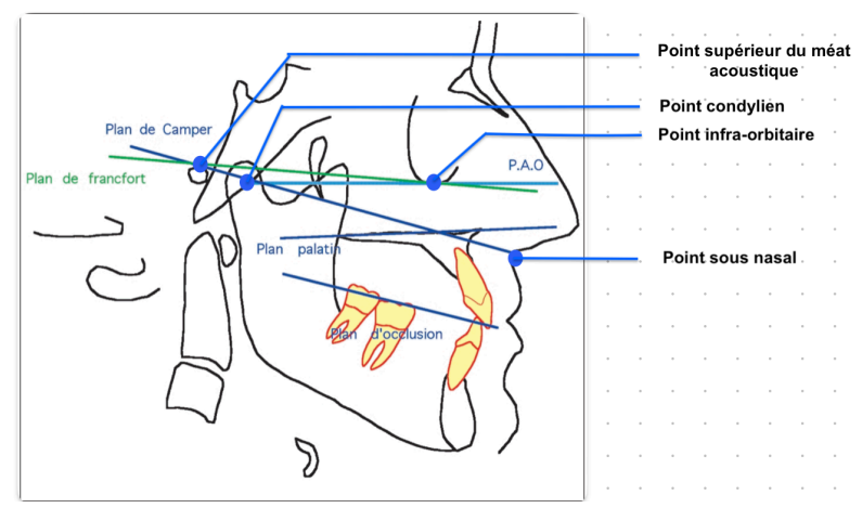 Le PAO et Plan de Francfort - vue sagittale 