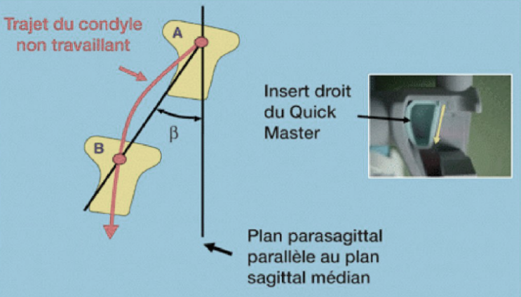 L’angle de Bennett