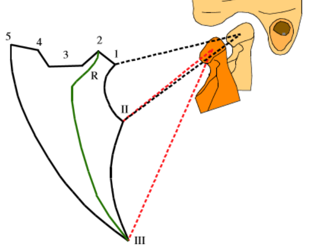 Diagramme de Posselt dans le plan sagittal (19)
Point 1:
RC.
Point 2: OIΜ.
Trajet 3: glissement des incisives en bout à bout jusqu'au point 4, correspondant à la perte de contact incisif.
Point 5: propulsion maximale.
Trajet II: limite de rotation pure du condyle mandibulaire.
Trajet III: ouverture buccale maximale.
Trajet R: trajet d'ouverture habituelle.
