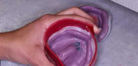 Section Laboratoire — Coffrage
Image 7 — Coulée du modèle en plâtre