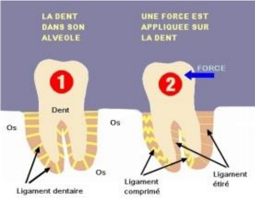 Effets mécaniques immédiats de l’application d’une force orthodontique sur une dent