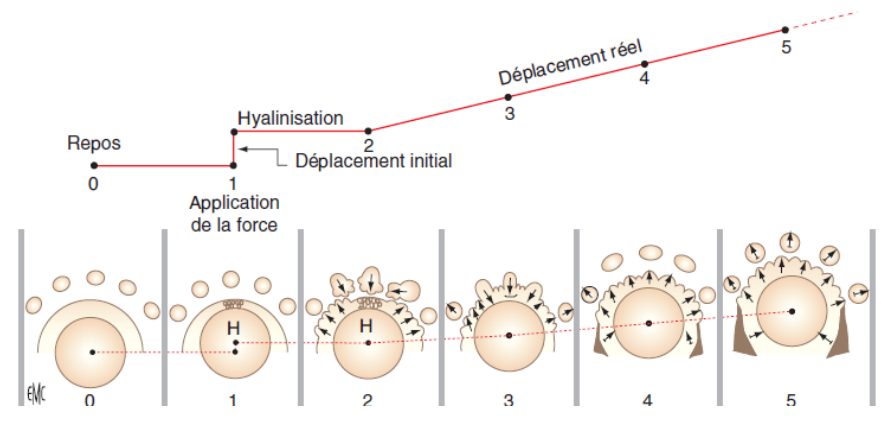 Correspondance entre la courbe de déplacement et les différents stades morphologiques de la réaction osseuse. H : hyalinisation.