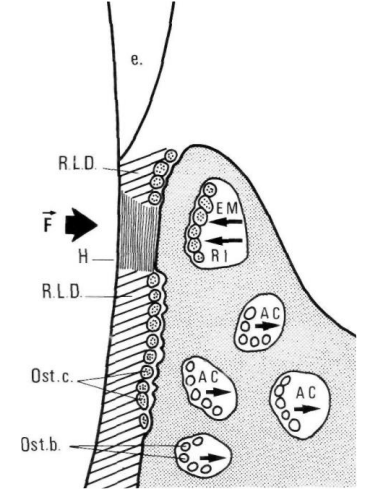 Fig. : Modifications histologiques au niveau d'une zone comprimée (d'après BARON).
R. L. D. = résorption latérale directe. R. I. = résorption indirecte. H = hyalinisation.
A. C. = apposition compensatrice. Ost.c. = ostéoclastes. Ost.b. = ostéoblastes.
F = direction de la force. e. = émail.