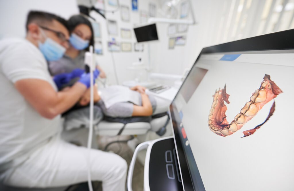 scanner intra-oral empreinte numérique implant