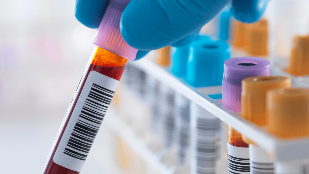 Tubes de prélèvement sanguin / bilan biologique — illustrer les bilans préopératoires

