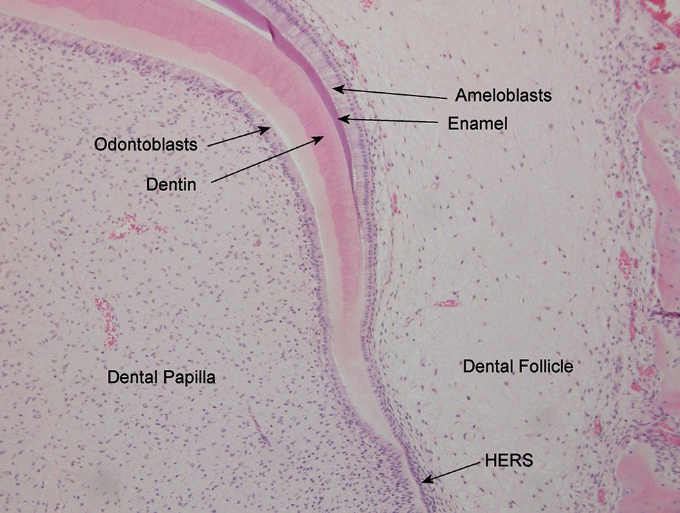 rests of Malassez histology epithelial