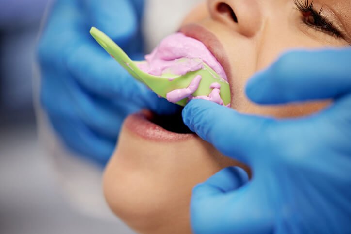 Dentiste prenant une empreinte dentaire en cabinet