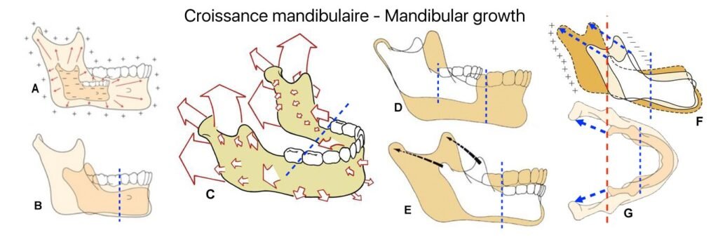 Croissance faciale orthodontie