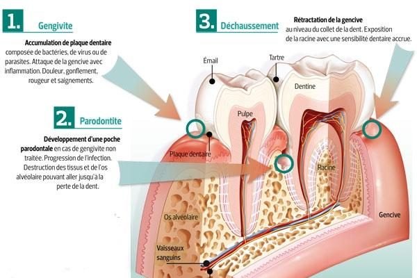 anatomie gencive schéma