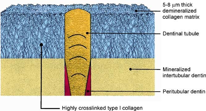hybrid layer schematic dentin collagen resin infiltration diagram