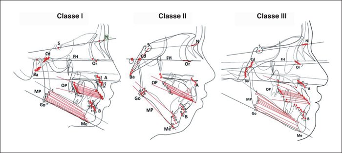 Plans de référence orthodontie