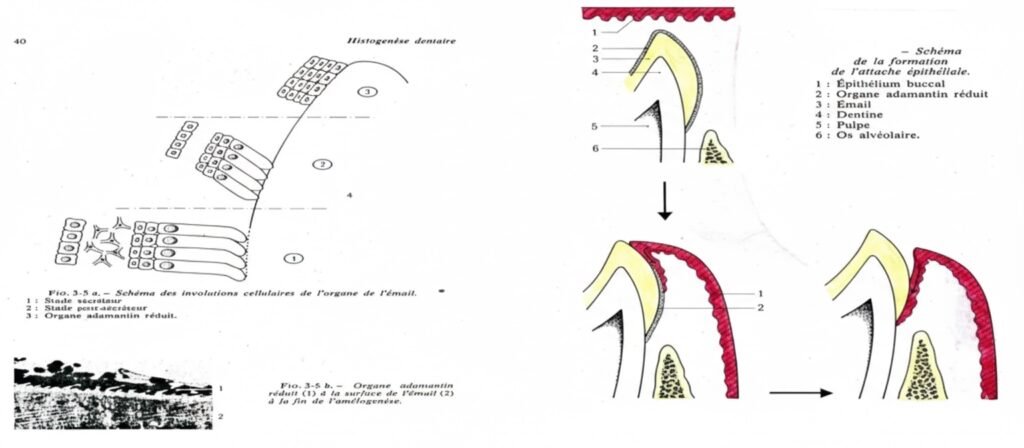 Transition entre Attache Épithéliale Primaire et Secondaire