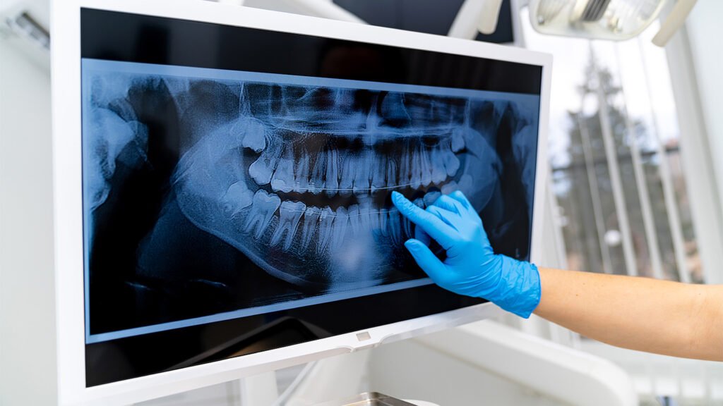 Dentiste examinant radiographie panoramique dentaire
