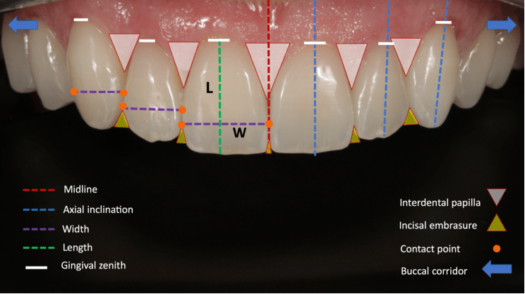  Embrasures et papille interdentaire