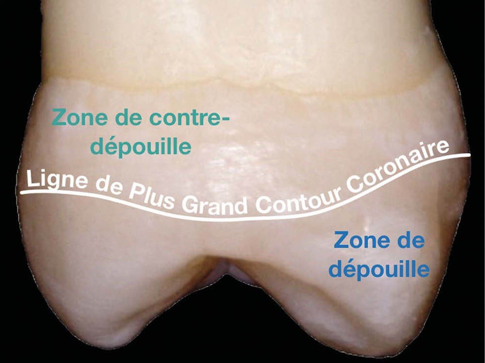 Ligne de Plus Grand Contour