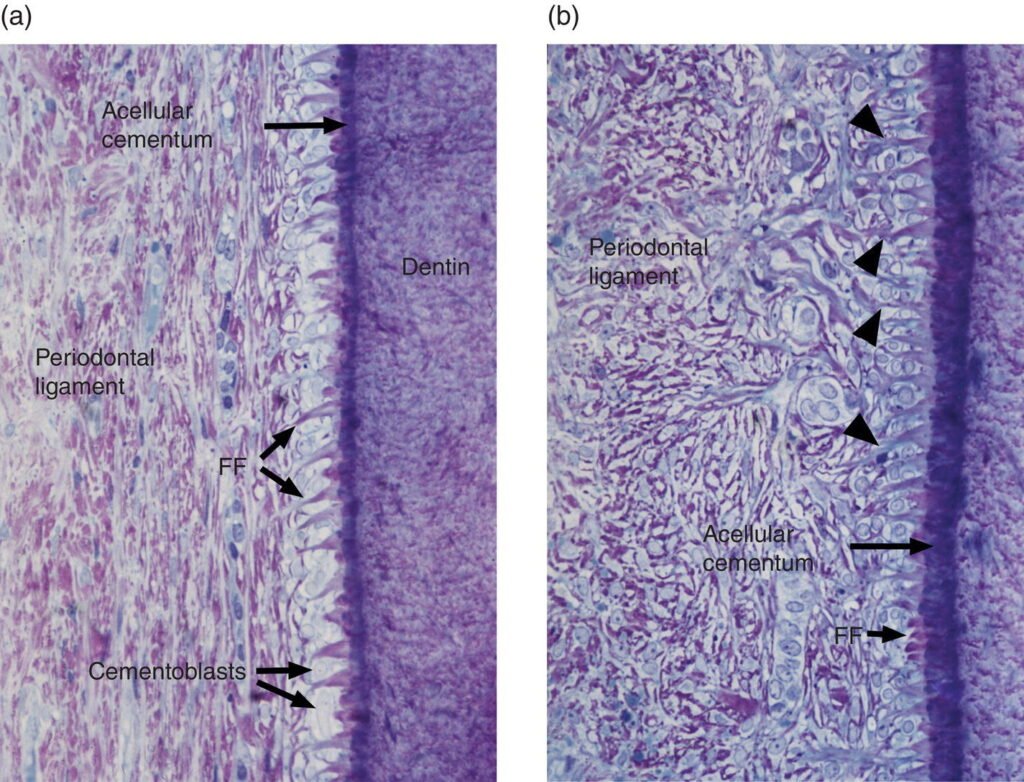 Coupe histologique du desmodonte (fibres, cellules, vaisseaux)