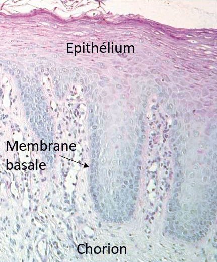 Coupe histologique de la muqueuse orale (épithélium malpighien, membrane basale, chorion)