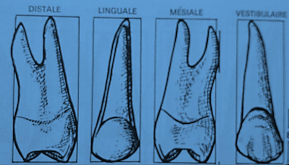 Les Prémolaires Maxillaires – Odontologie Conservatrice Endodontie