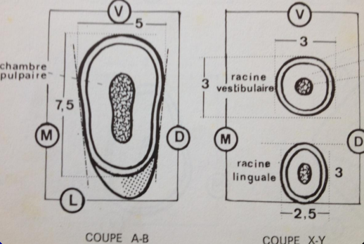 Les Prémolaires Maxillaires – Odontologie Conservatrice Endodontie