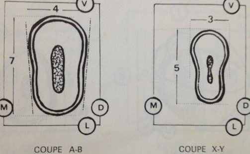 Les Prémolaires Maxillaires – Odontologie Conservatrice Endodontie