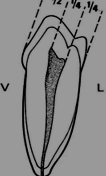 Les Prémolaires Inferieures– Odontologie Conservatrice Endodontie